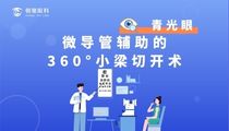 微导管辅助的360°小梁切开术